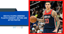 Did Kyle Kuzma Undergo Plastic Surgery: Before And After Photos