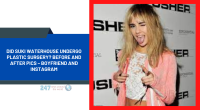 Did Suki Waterhouse Undergo Plastic Surgery? Before And After Pics – Boyfriend And Instagram