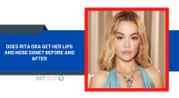 Does Rita Ora Get Her Lips And Nose Done? Before And After