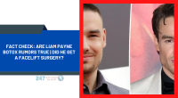 Fact Check: Are Liam Payne Botox Rumors True | Did He Get A Facelift Surgery?