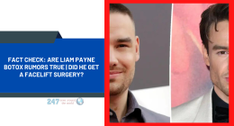 Fact Check: Are Liam Payne Botox Rumors True | Did He Get A Facelift Surgery?