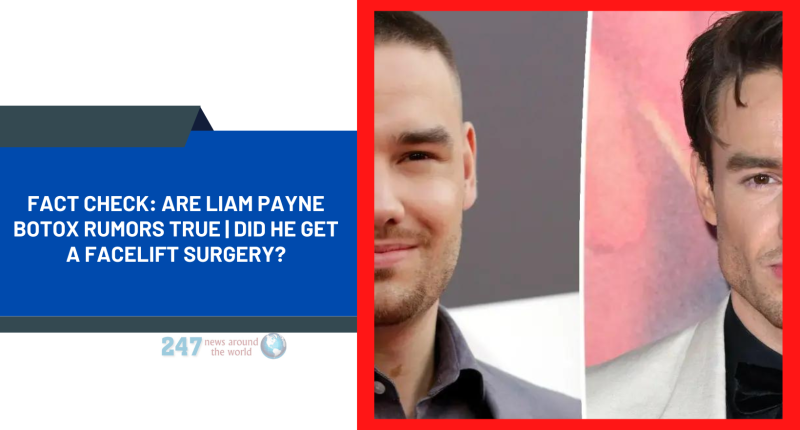 Fact Check: Are Liam Payne Botox Rumors True | Did He Get A Facelift Surgery?