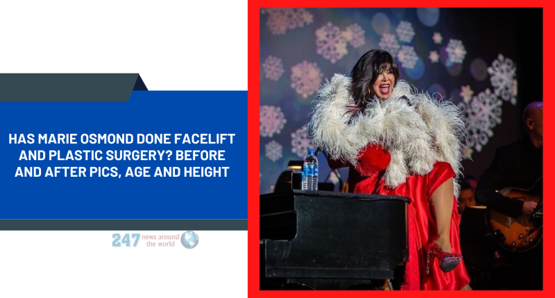 Has Marie Osmond Done Facelift And Plastic Surgery? Before And After Pics, Age And Height