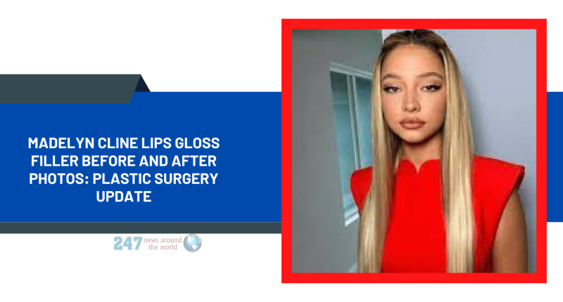 Madelyn Cline Lips Gloss Filler Before And After Photos: Plastic Surgery Update