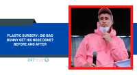 Plastic Surgery: Did Bad Bunny Get His Nose Done? Before And After