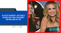 Plastic Surgery: Did Carly Pearce Get Her Lips Done? Before And After