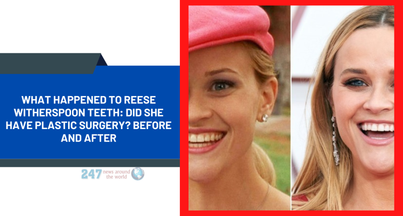 What Happened To Reese Witherspoon Teeth: Did She Have Plastic Surgery? Before And After