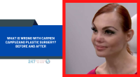 What Is Wrong With Carmen Campuzano Plastic Surgery? Before And After