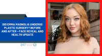 Did Emma Magnolia Undergo Plastic Surgery? Before And After – Face Reveal And Health Update