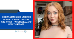 Did Emma Magnolia Undergo Plastic Surgery? Before And After – Face Reveal And Health Update