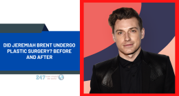 Did Jeremiah Brent Undergo Plastic Surgery? Before And After