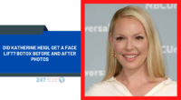 Did Katherine Heigl Get A Face Lift? Botox Before And After Photos