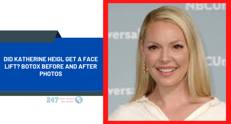 Did Katherine Heigl Get A Face Lift? Botox Before And After Photos