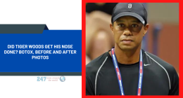 Did Tiger Woods Get His Nose Done? Botox, Before And After Photos