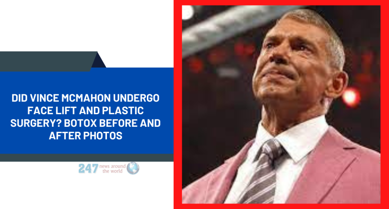 Did Vince McMahon Undergo Face Lift And Plastic Surgery? Botox Before And After Photos