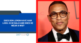 Does Don Lemon Have Hair Loss: Is He Bald And Does He Wear A Wig?