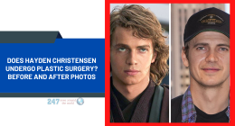 Does Hayden Christensen Undergo Plastic Surgery? Before And After Photos