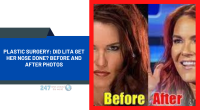 Plastic Surgery: Did Lita Get Her Nose Done? Before And After Photos