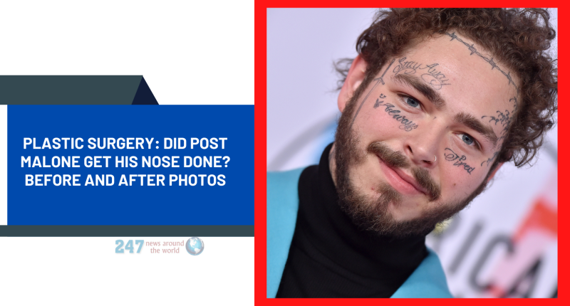 Plastic Surgery: Did Post Malone Get His Nose Done? Before And After Photos
