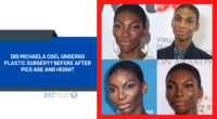 Did Michaela Coel Undergo Plastic Surgery, Before After Pics Age And Height