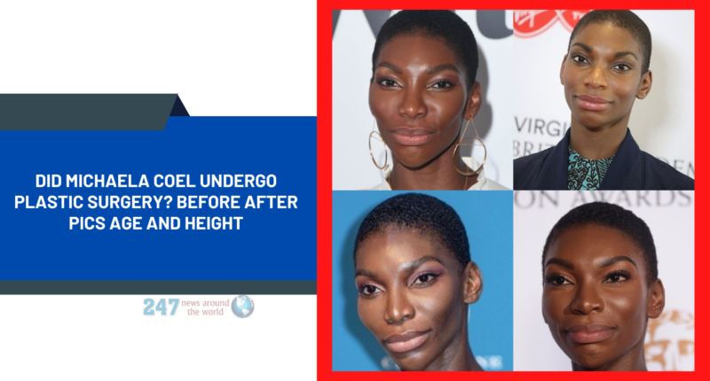 Did Michaela Coel Undergo Plastic Surgery, Before After Pics Age And Height