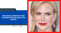 Does Nicole Kidman Get Her Lips Done? Before And After Photos