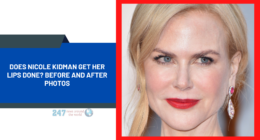 Does Nicole Kidman Get Her Lips Done? Before And After Photos