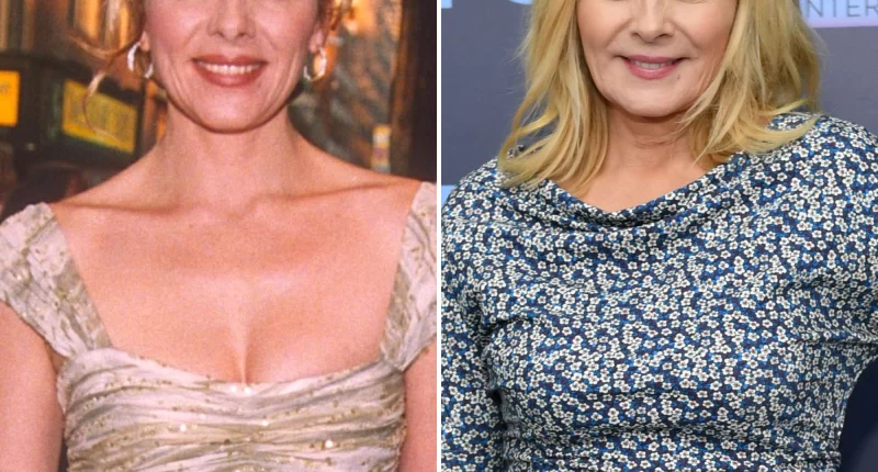Did Kim Cattrall Undergo Face Lift Surgery? Before And After Photo
