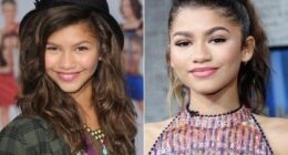 Zendaya Plastic Surgery Before and After: How Did She Get More Beautiful?