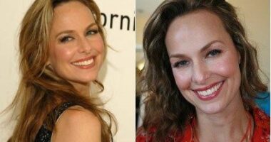 Melora Hardin Plastic Surgery Before and After Photos