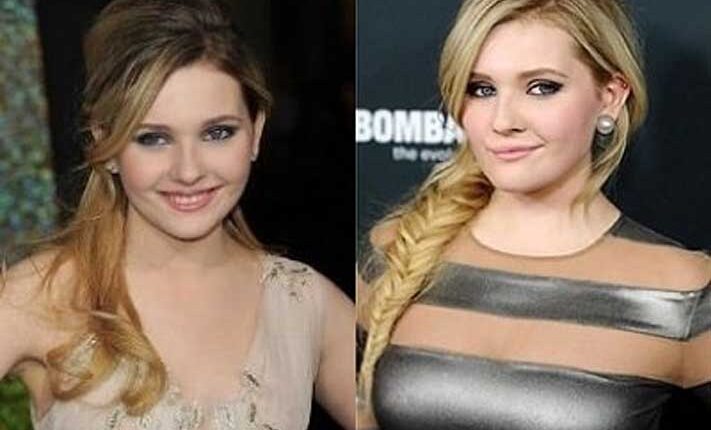 Abigail Breslin Plastic Surgery Before And After: Did She Get Nose Job Done?