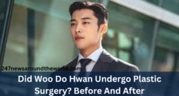 Did Woo Do Hwan Undergo Plastic Surgery? Before And After