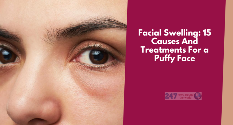 Facial Swelling: 15 Causes And Treatments For a Puffy Face