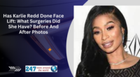Has Karlie Redd Done Face Lift: What Surgeries Did She Have? Before And After Photos