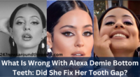 What Is Wrong With Alexa Demie Bottom Teeth: Did She Fix Her Tooth Gap?