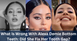 What Is Wrong With Alexa Demie Bottom Teeth: Did She Fix Her Tooth Gap?