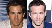 Ryan Reynolds Plastic Surgery Before and After: Did He Fix Teeth Veneers, Botox, Hair Transplant