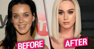 Did Katy Perry Undergo Plastic Surgery? Before and After