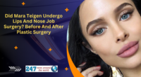 Did Mara Teigen Undergo Lips And Nose Job Surgery? Before And After Plastic Surgery