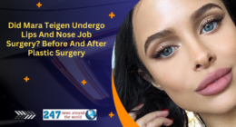 Did Mara Teigen Undergo Lips And Nose Job Surgery? Before And After Plastic Surgery