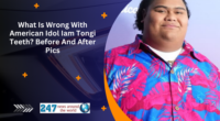 What Is Wrong With American Idol Iam Tongi Teeth? Before And After Pics