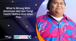 What Is Wrong With American Idol Iam Tongi Teeth? Before And After Pics