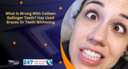 What Is Wrong With Colleen Ballinger Teeth? Has Used Braces Or Teeth Whitening