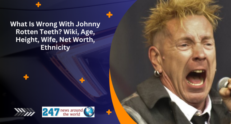 What Is Wrong With Johnny Rotten Teeth? Wiki, Age, Height, Wife, Net Worth, Ethnicity