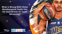 What Is Wrong With Victor Wembanyama Teeth: Has He Used Braces Or Teeth Whitening?