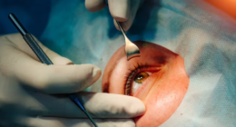 How to Maintain Healthy Eyesight After Lasik
