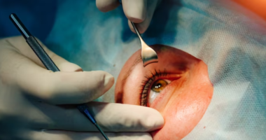 How to Maintain Healthy Eyesight After Lasik