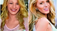 Why Did Blake Lively’s Alleged of Plastic Surgery: What’s The Real Story?