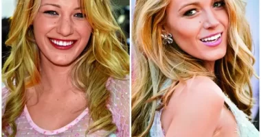 Why Did Blake Lively’s Alleged of Plastic Surgery: What’s The Real Story?