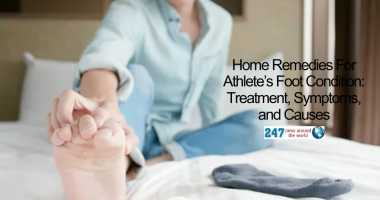 Home Remedies For Athlete’s Foot Condition: Treatment, Symptoms, and Causes